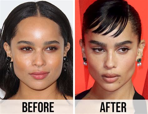 zoe kravitz plastic surgery|Zoe Kravitz Before and After Plastic Surgery